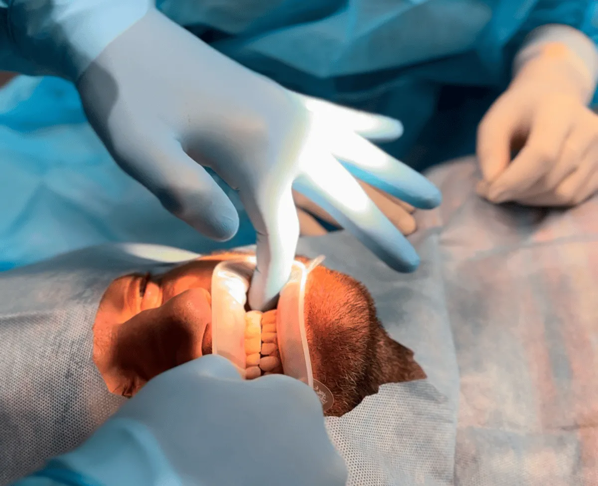 zabieg-implantologiczny-olsztyn-przebieg