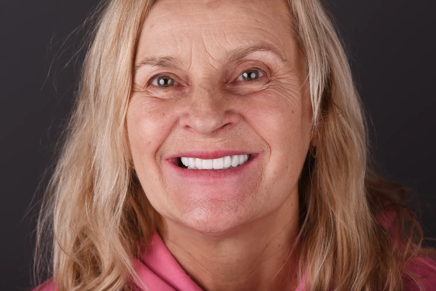 all-on-4-olsztyn-zeby-w-jeden-dzien