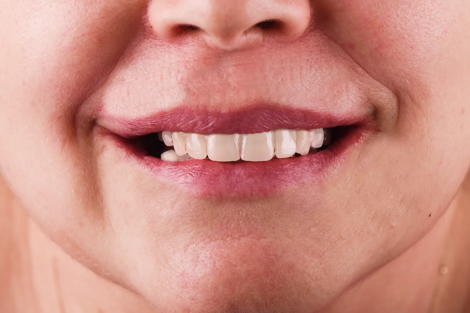 trwale-uzupelnienie-brakow-zebowych-implanty-olsztyn (2)