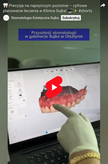 cyfrowe-planowanie-leczenia