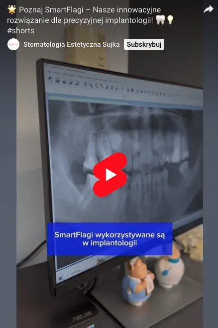 precyzyjna-implantologia-olsztyn