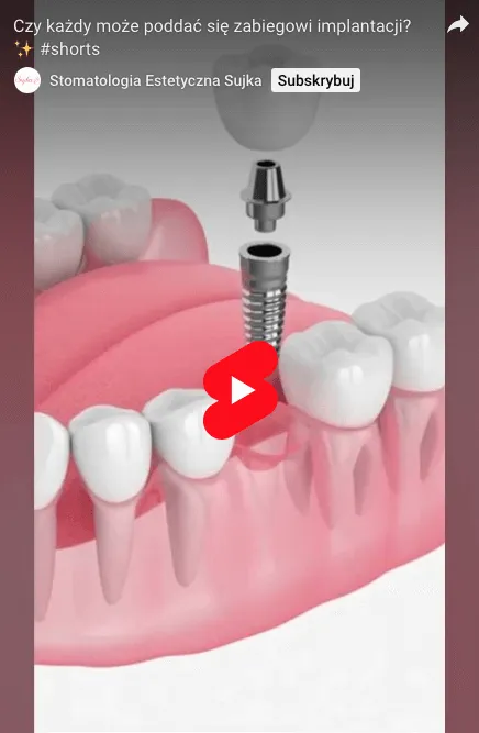 implantacja-dla-kogo