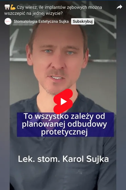 ile-implantow-zebowych-mozna-wszczepic
