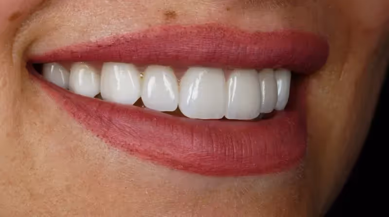 Smile Makeovers in Pittsburgh, PA