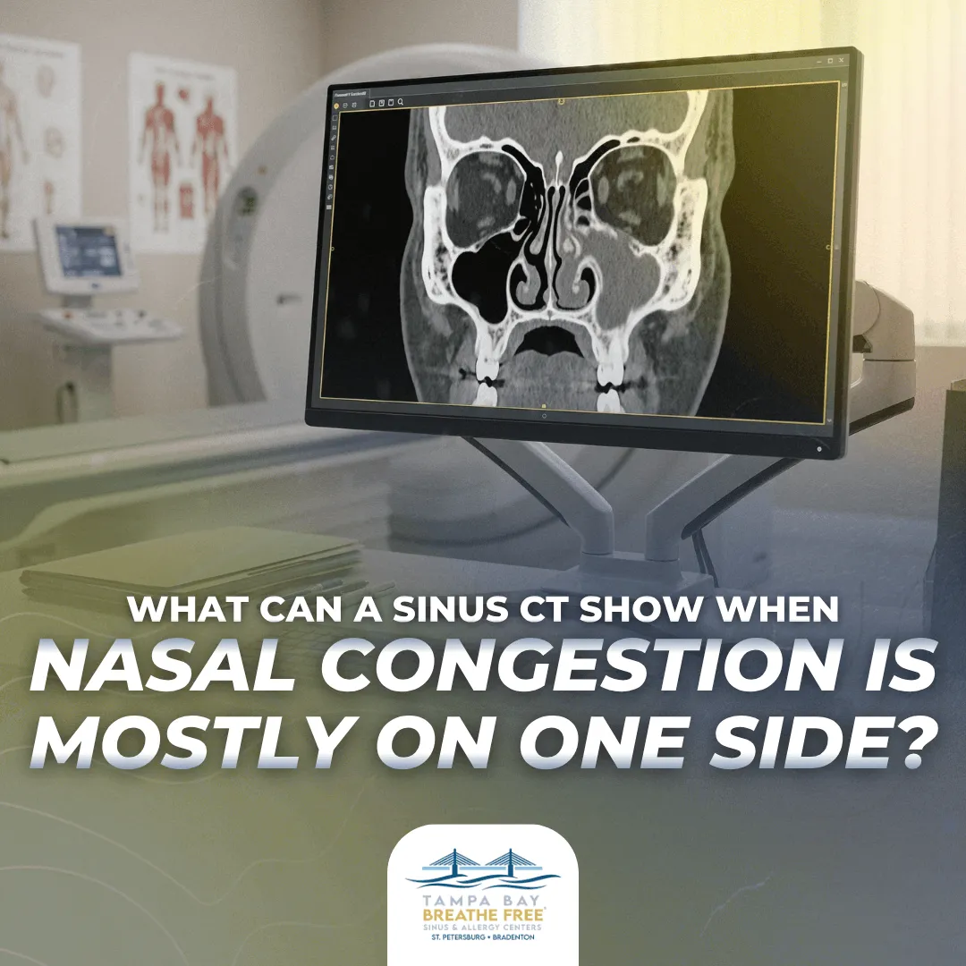 What Can a Sinus CT Show When Nasal Congestion Is Mostly on One Side?