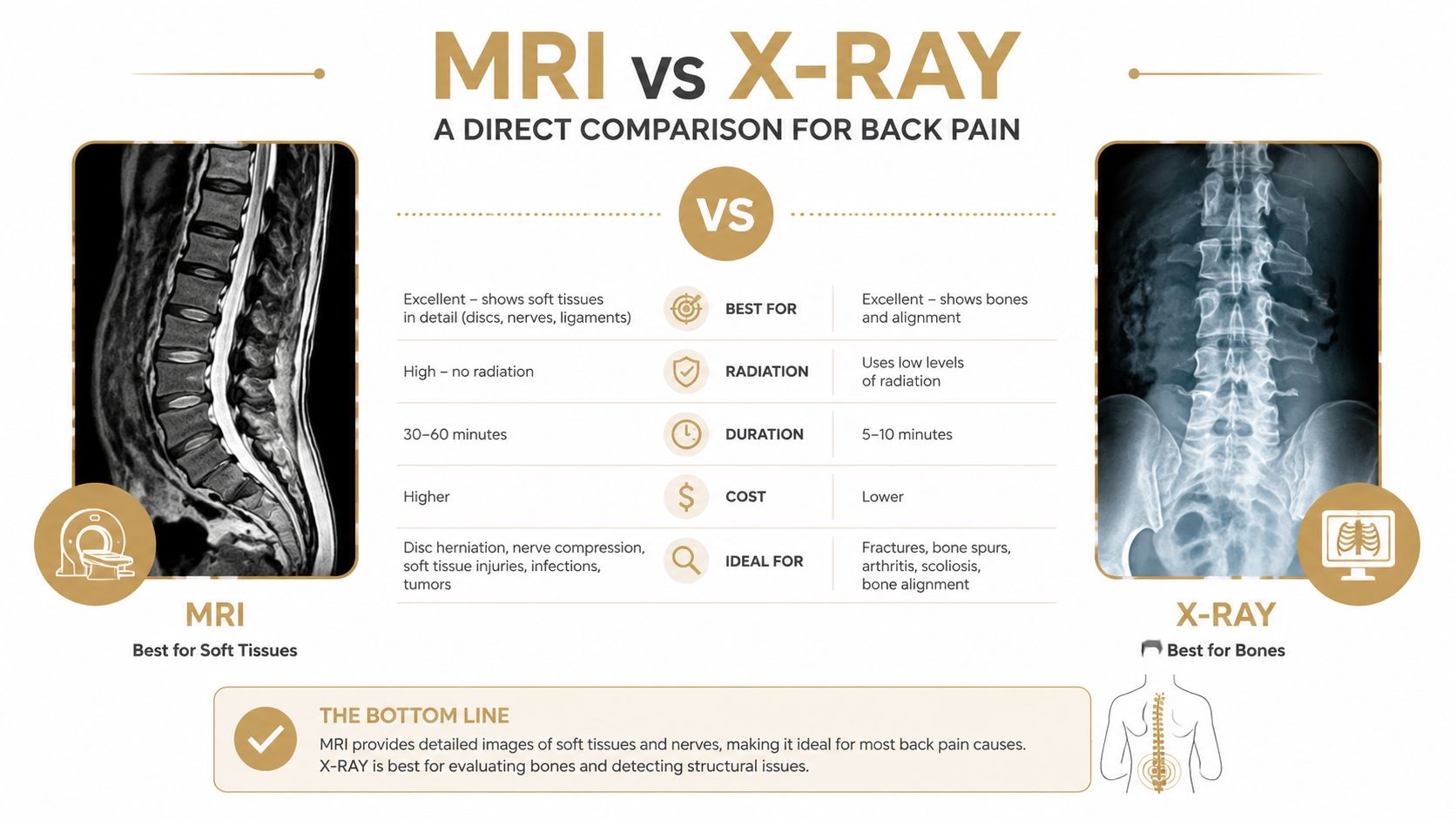 A comparison infographic detailing the differences between MRI and X-ray imaging for diagnosing back pain.