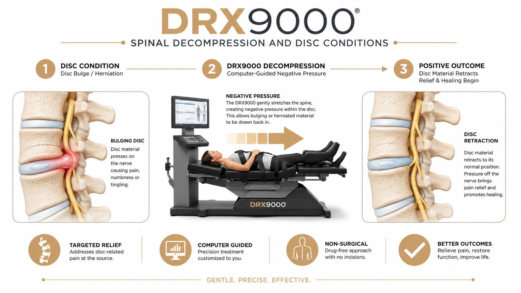 A diagram illustrating how the DRX9000 spinal decompression system relieves pain caused by bulging or herniated discs.