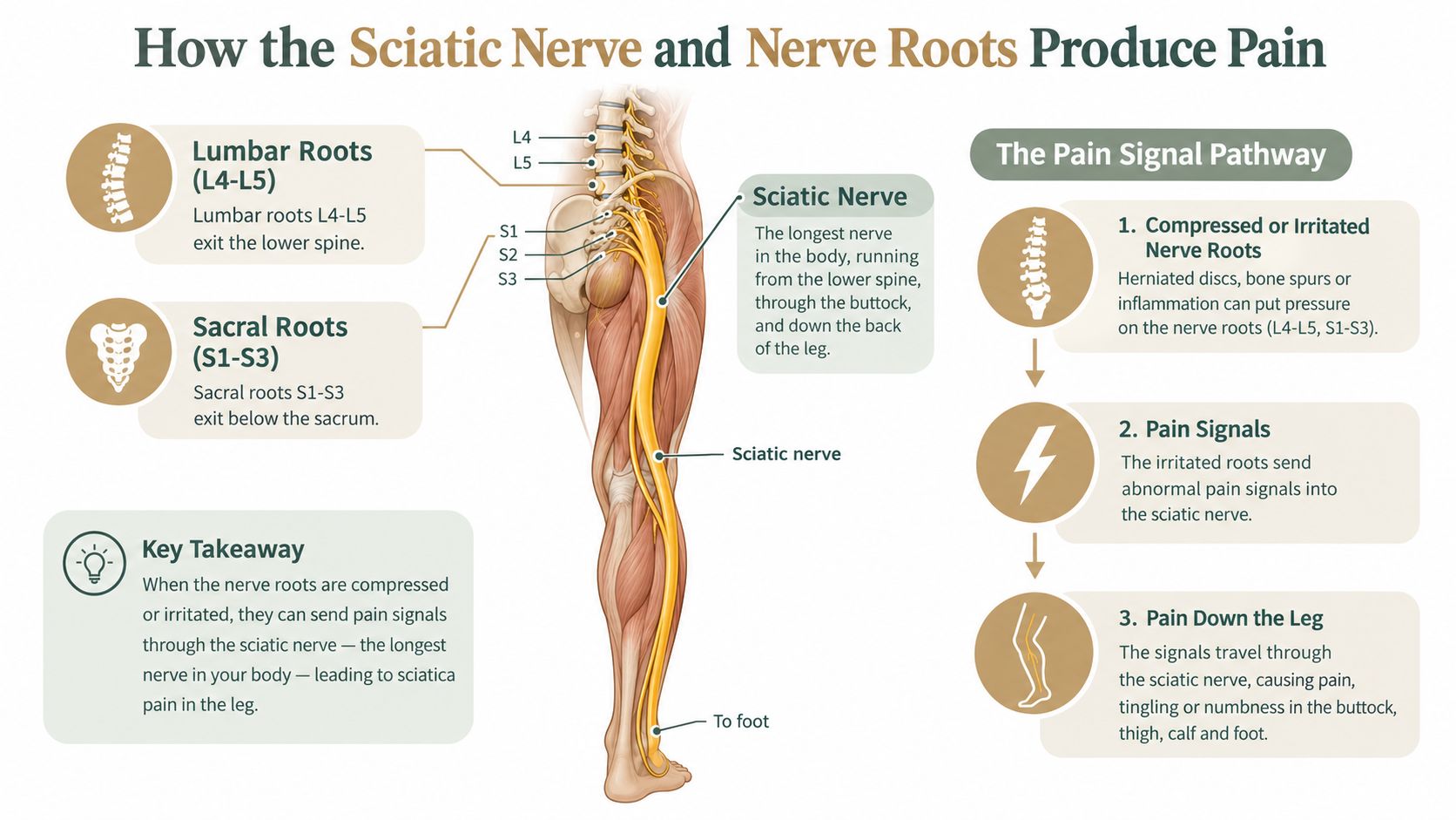 An infographic showing the anatomical path of the sciatic nerve and how nerve compression causes leg pain.