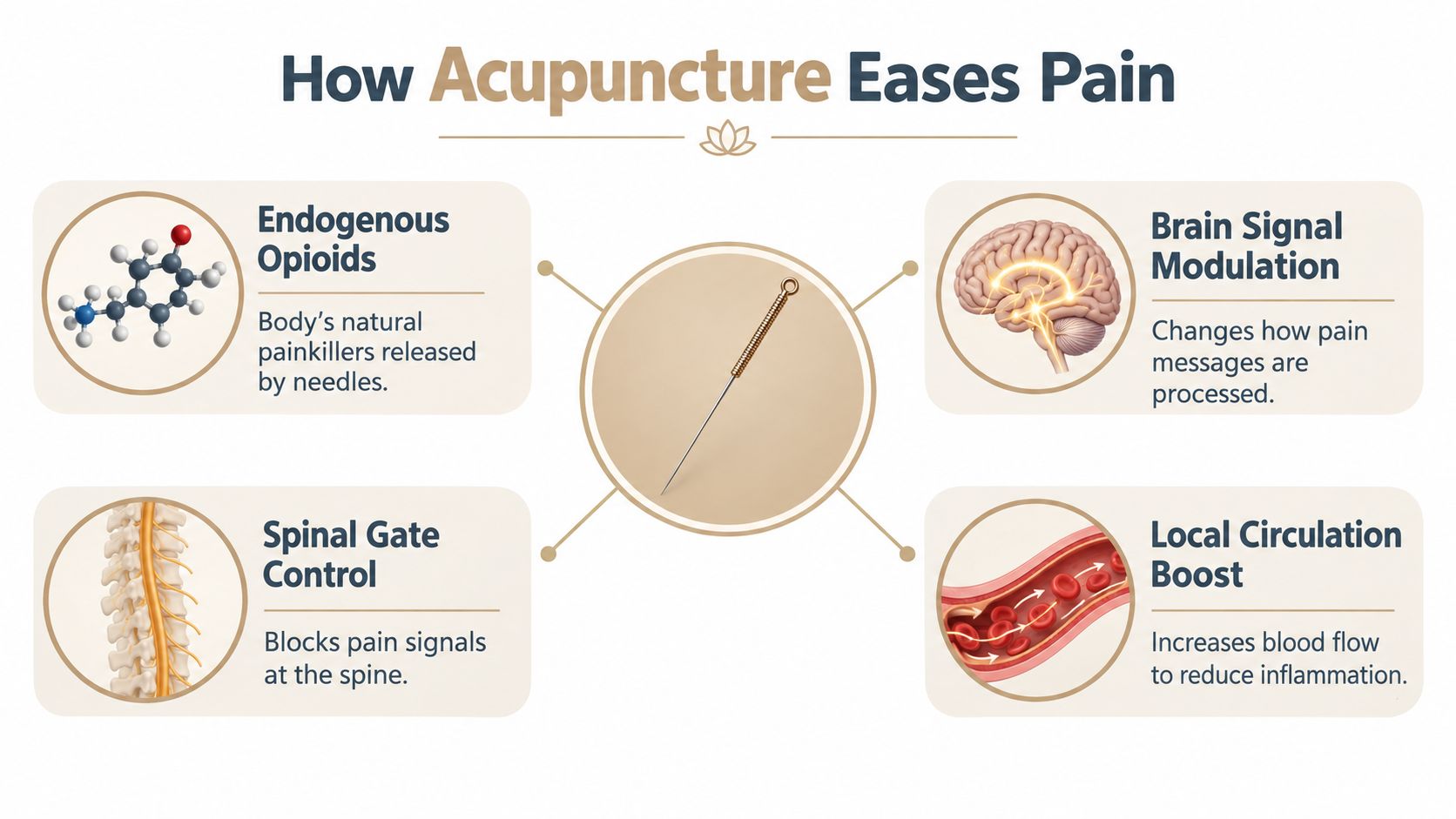 An infographic titled How Acupuncture Eases Pain, illustrating four biological mechanisms: endogenous opioids, brain modulation, spinal gates, and circulation.