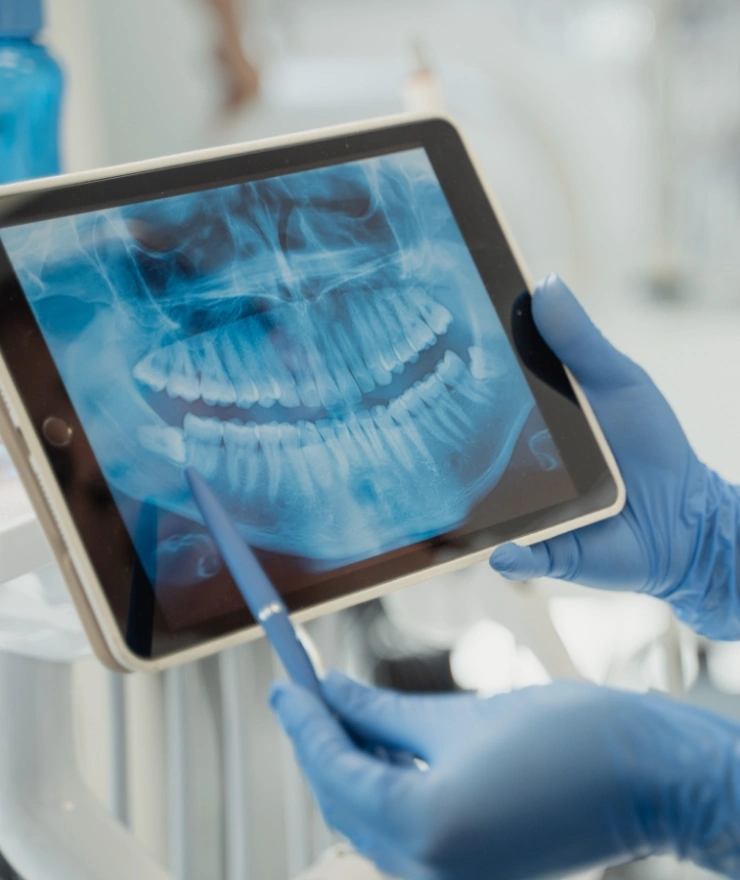 Apparecchio dentale e ortodonzia per adulti e bambini a Pordenone