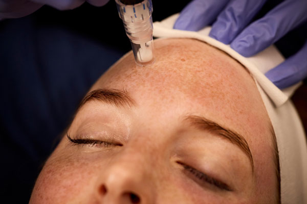 Gentleman receiving stem cell hair regrowth treatment
