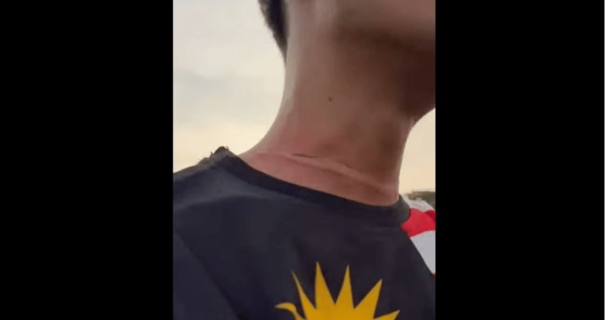 Kite String Slashes Motorcyclist’s Neck in Freak Accident on MRR2 Near Kepong Park