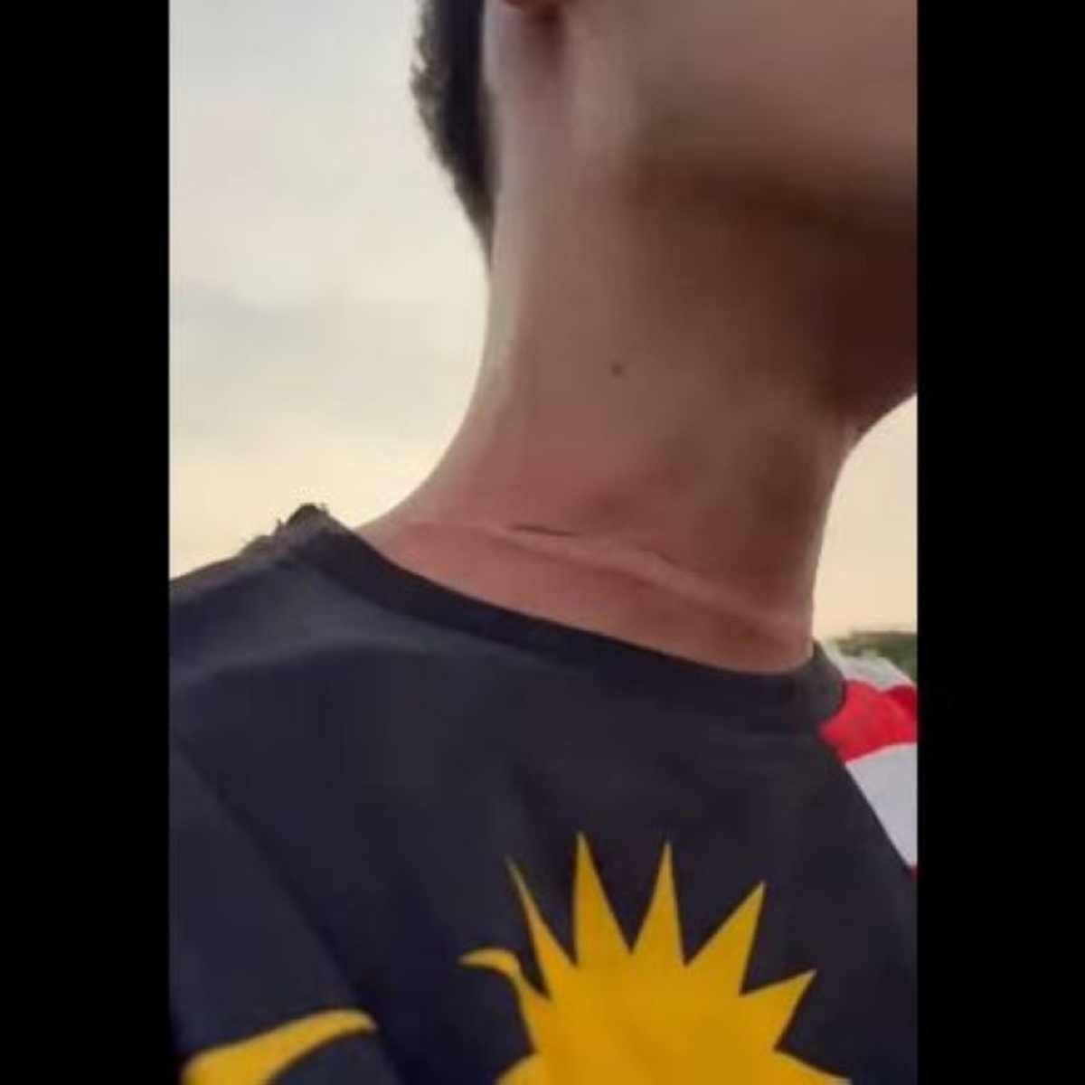 Kite String Slashes Motorcyclist’s Neck in Freak Accident on MRR2 Near Kepong Park