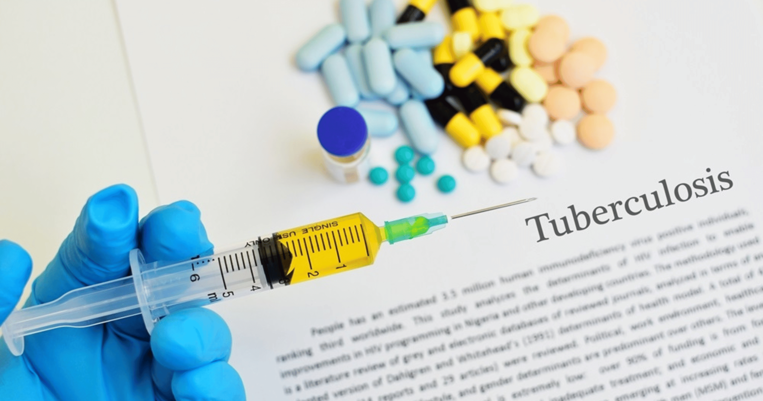 Malaysia Health Minister: 85% of TB Cases Involve Locals