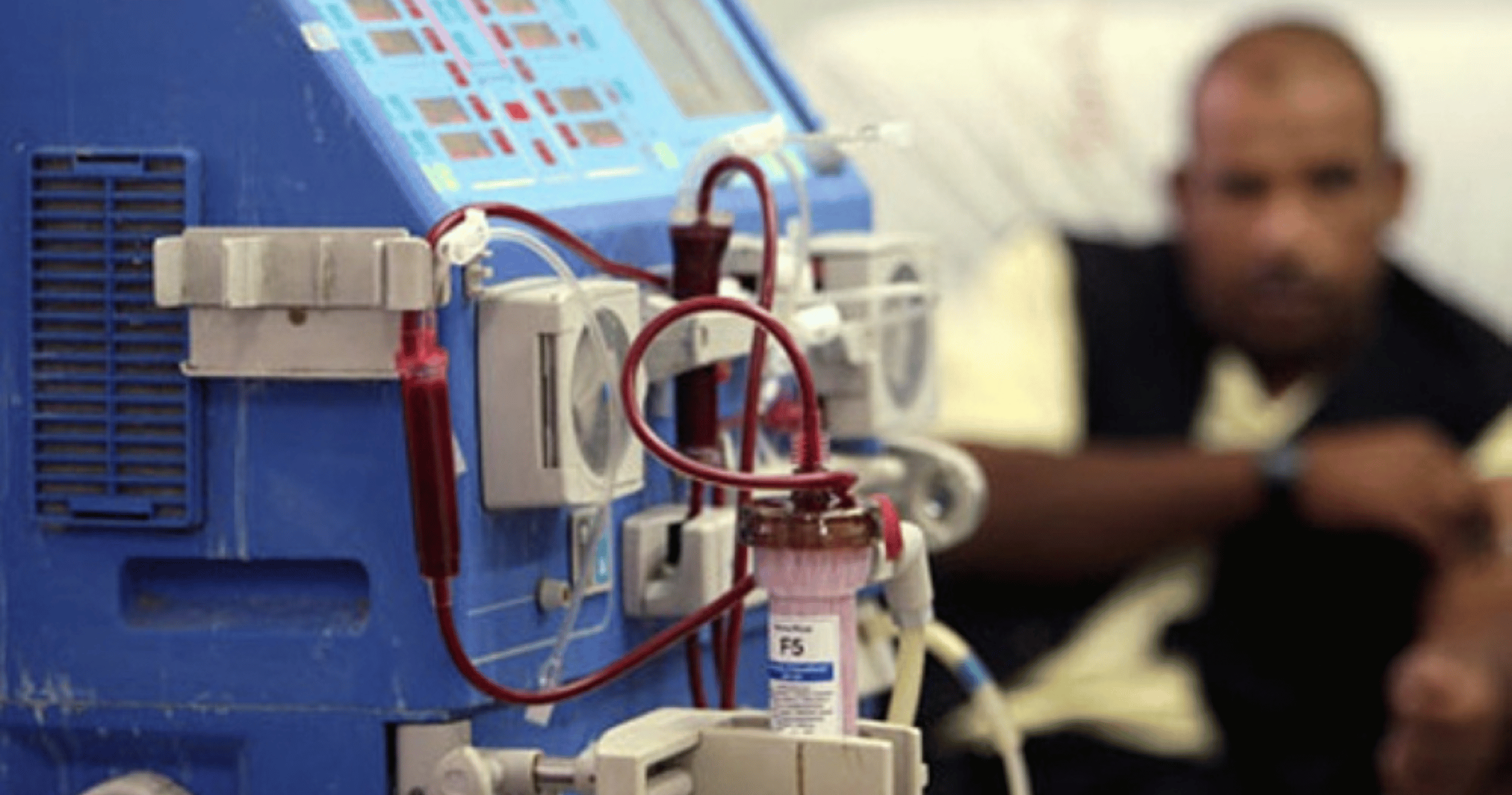 Diabetes-related kidney disease cases are increasing, costing Malaysia RM3.3 billion annually, says the health minister.