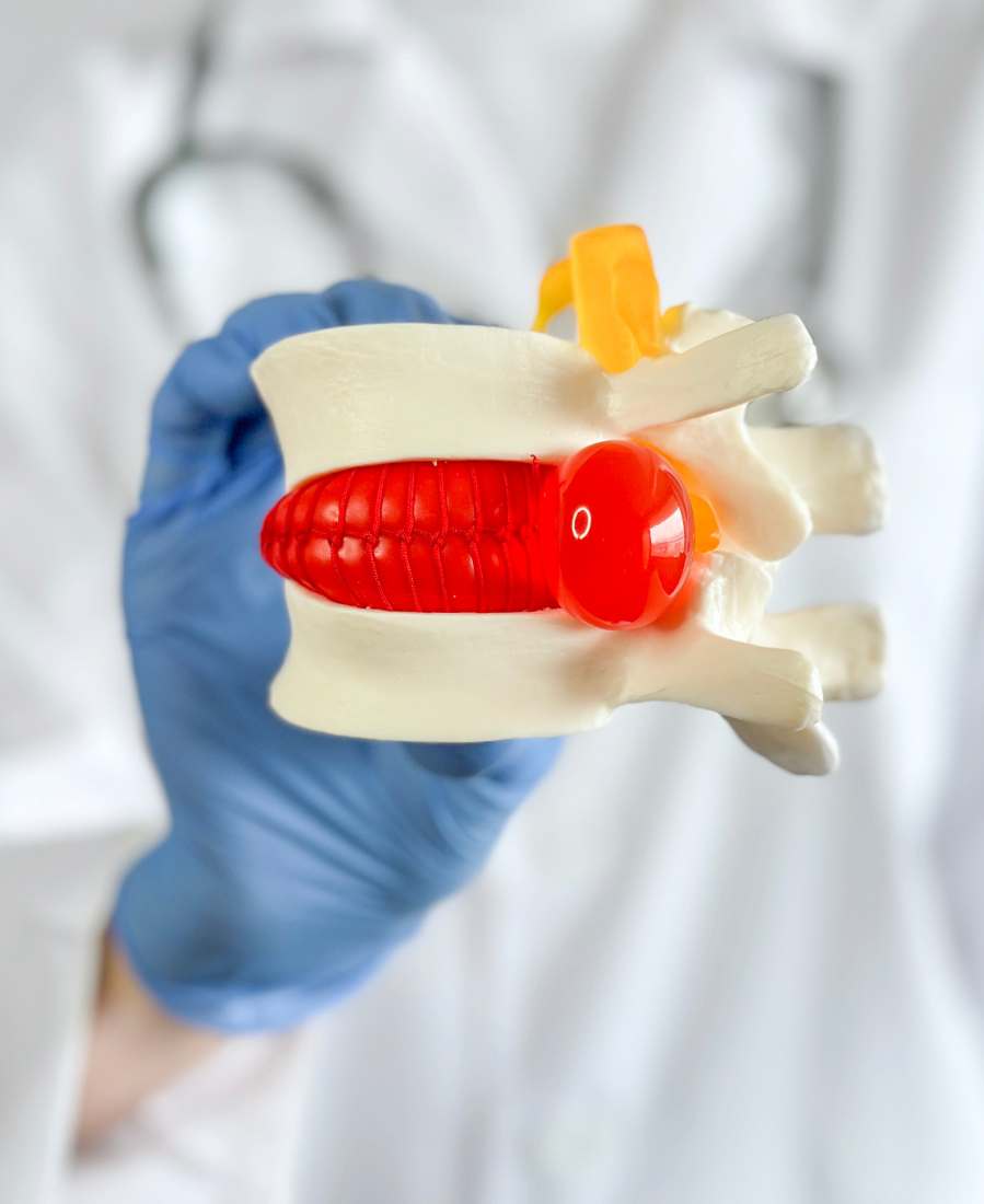 Herniated Discs: What They Are and How Chiropractic Care Can Help