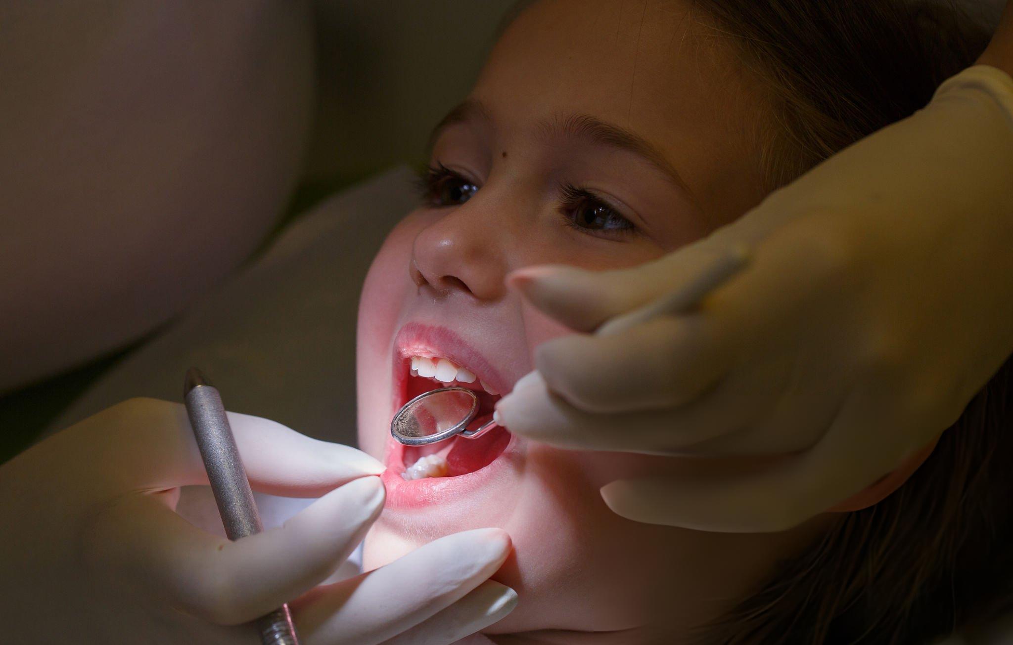 Pediatric Dental Filling Nashville