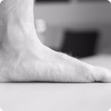 This image is representing Flat Feet