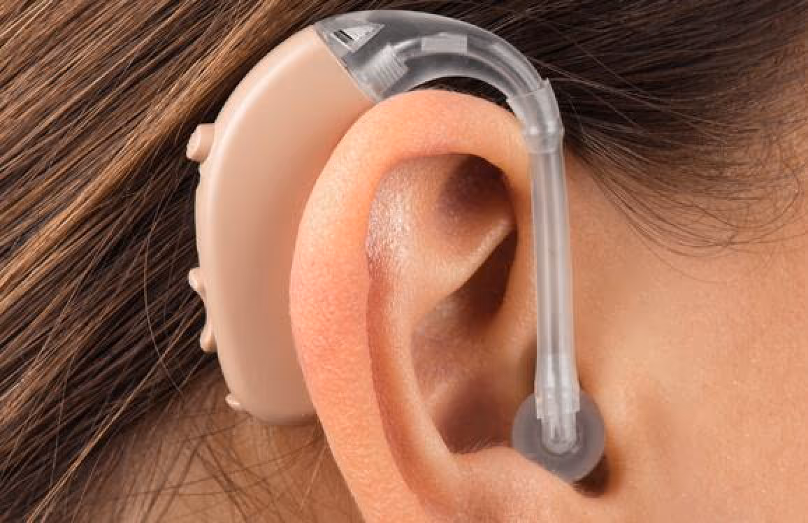 This image is representing Hearing Aids 