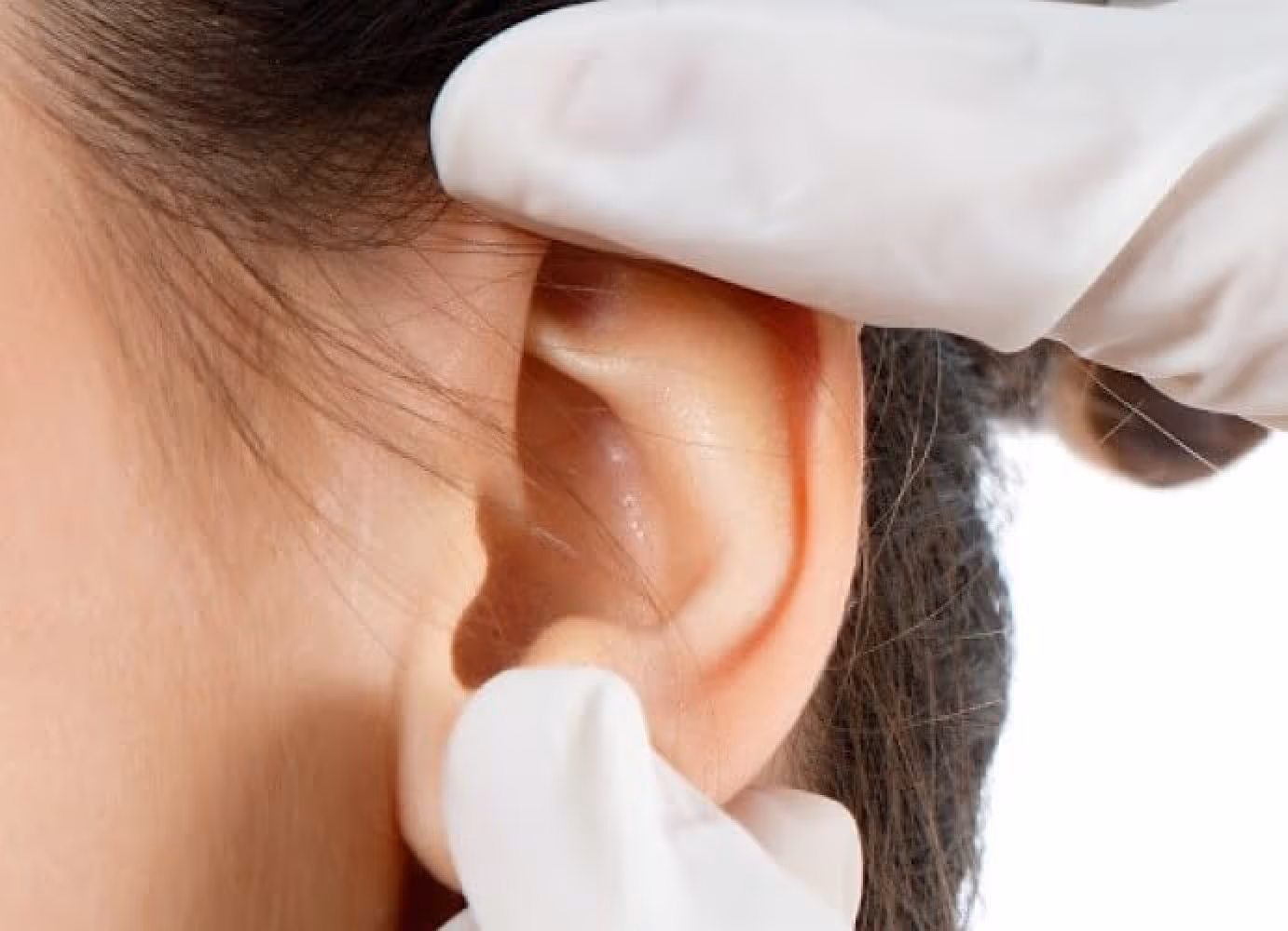 This image is representing Wax removal from the ears