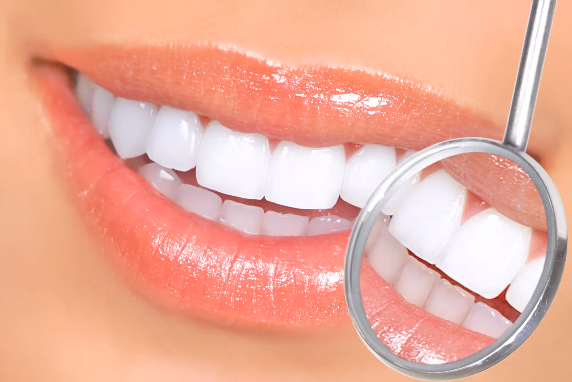 Teeth Whitening in Brandon | Southern Smile Studio