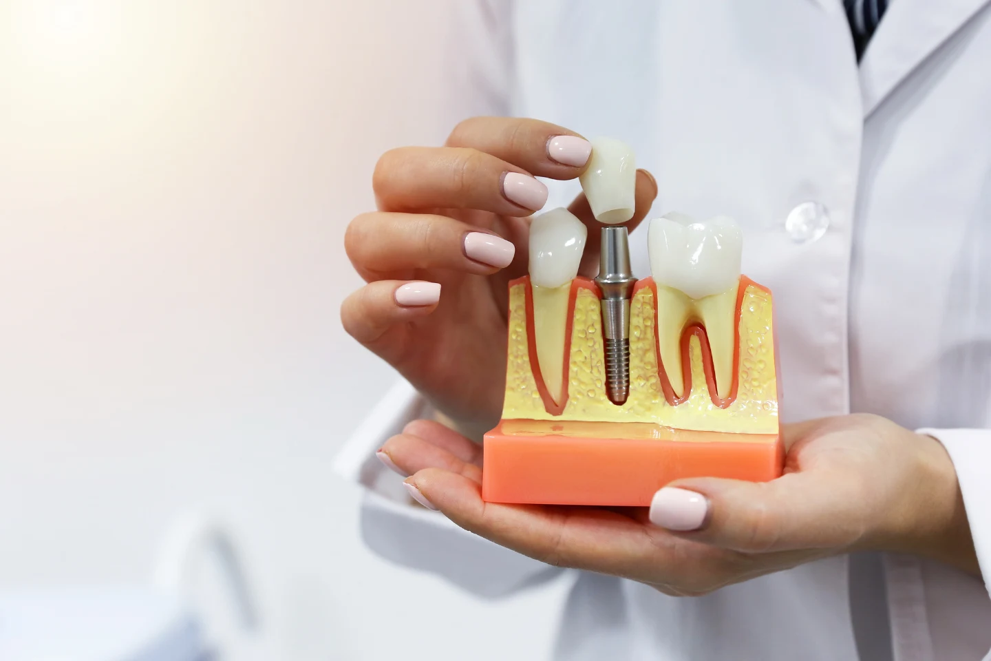 dentist holding an implant model