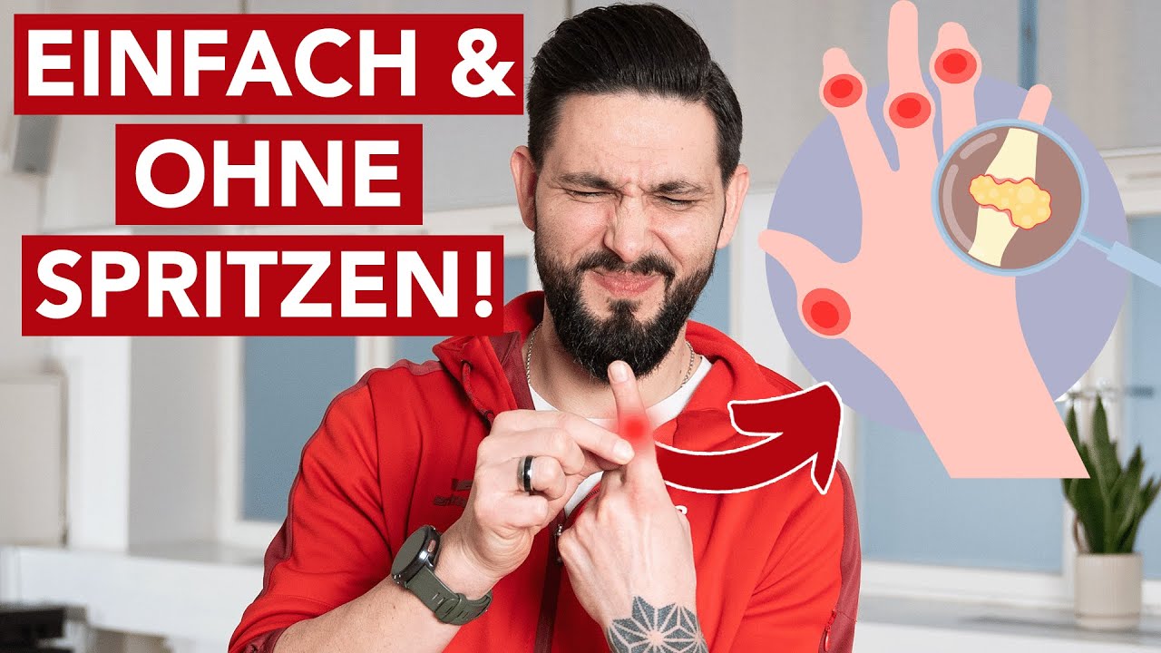 Fingerarthrose: Übungen für mehr Beweglichkeit und weniger Schmerzen