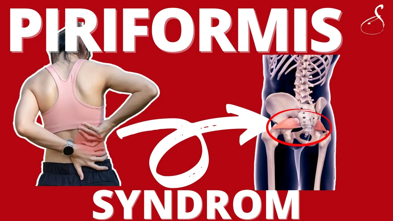 Piriformis Syndrom: Ursachen, Symptome und ganzheitliche Lösungsansätze