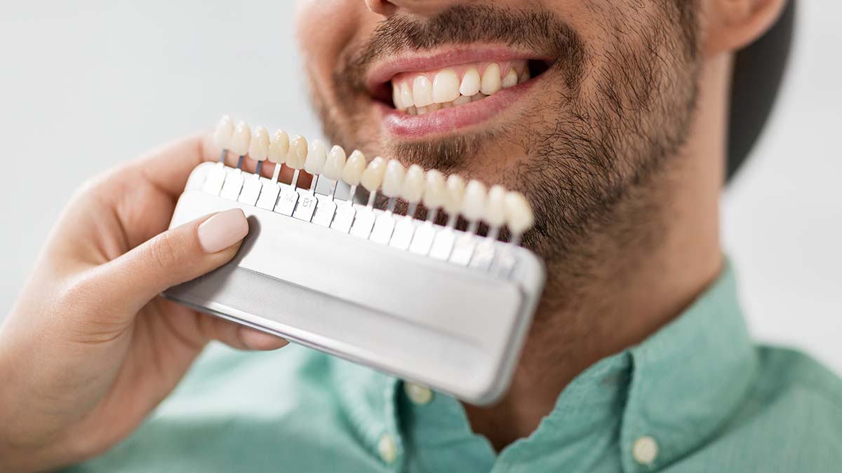 What to Expect: Getting Veneers in South Baltimore, MD