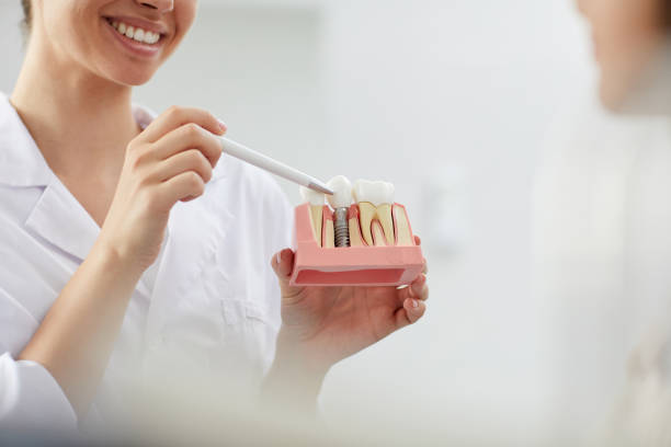 How Dental Implants Prevent Bone Loss: South Baltimore Dentist Explains