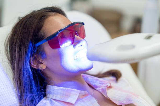 Professional Teeth Whitening in South Baltimore: What Patients Should Know
