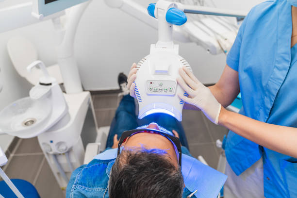 Common Causes of Tooth Discoloration Explained by South Baltimore Dentists