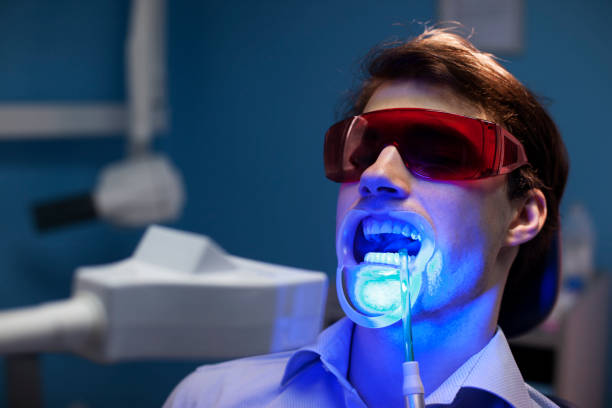 In-Office Teeth Whitening in South Baltimore: Step-by-Step Guide
