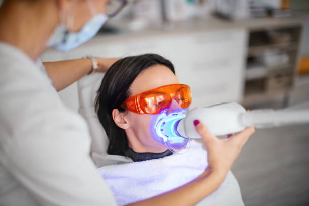 Teeth Whitening Costs in South Baltimore: What Patients Should Expect