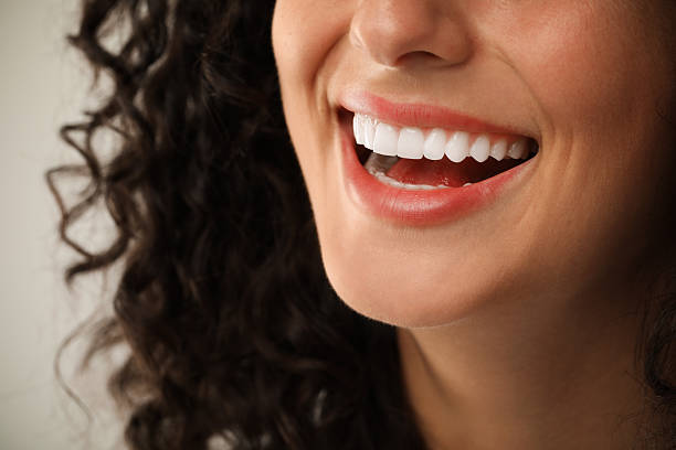 How Long Do Veneers Last in South Baltimore? Dentist’s Guide to Durability