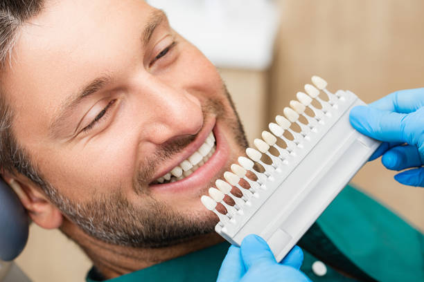 Replacing Old Veneers in South Baltimore: What Patients Should Expect