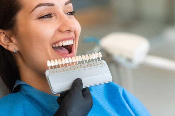 Porcelain Veneers in South Baltimore: Natural-Looking Smile Transformations