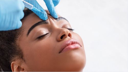REVOLAX Sub-Q dermal filler with lidocaine for deep wrinkles
