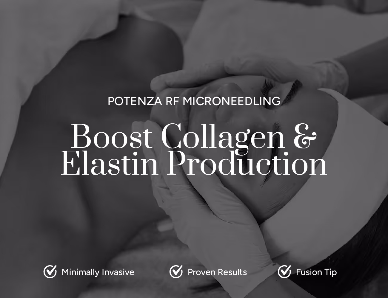 Potenza RF Microneedling for boosting collagen and elastin