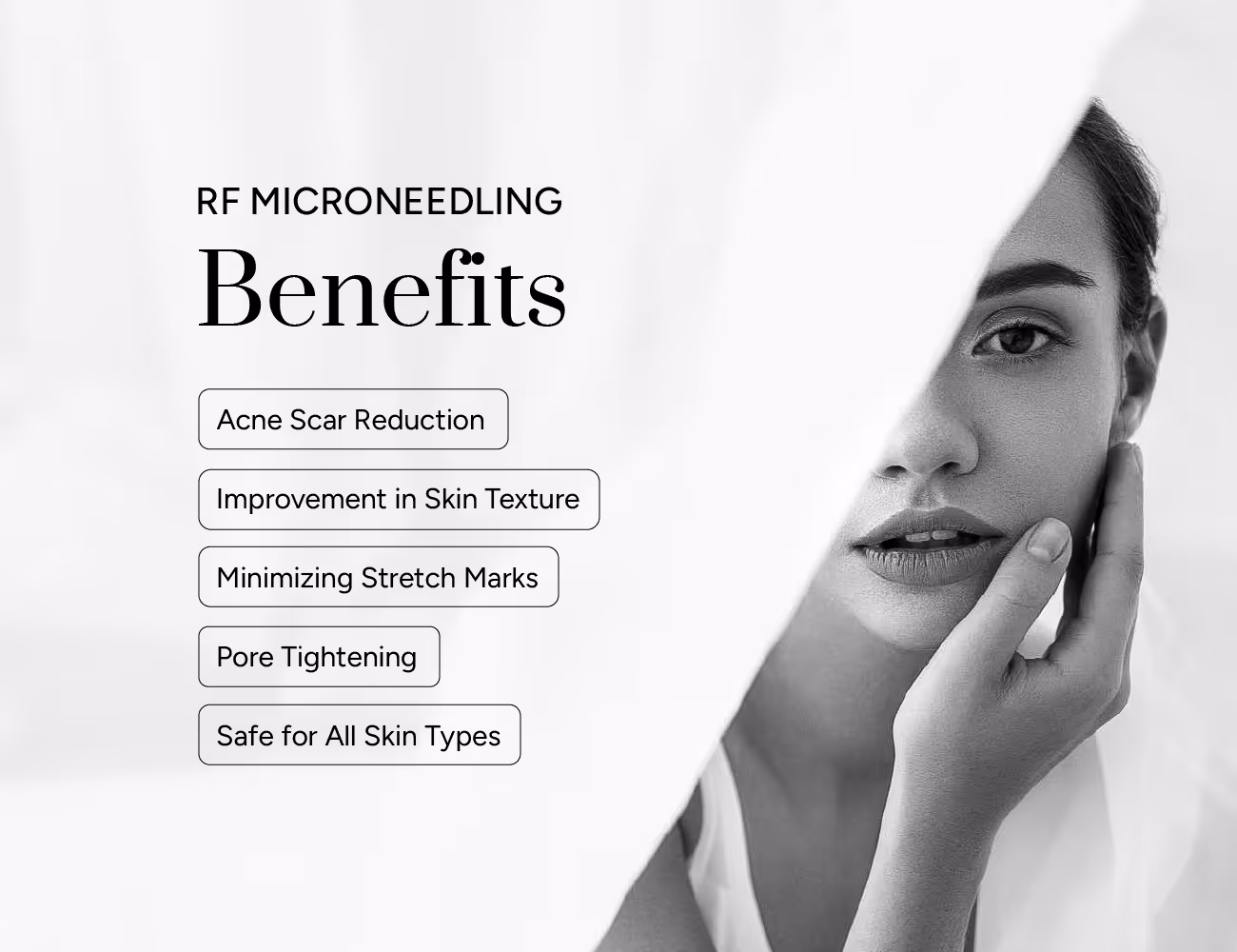 RF microneedling benefits: acne scars, skin texture, stretch marks