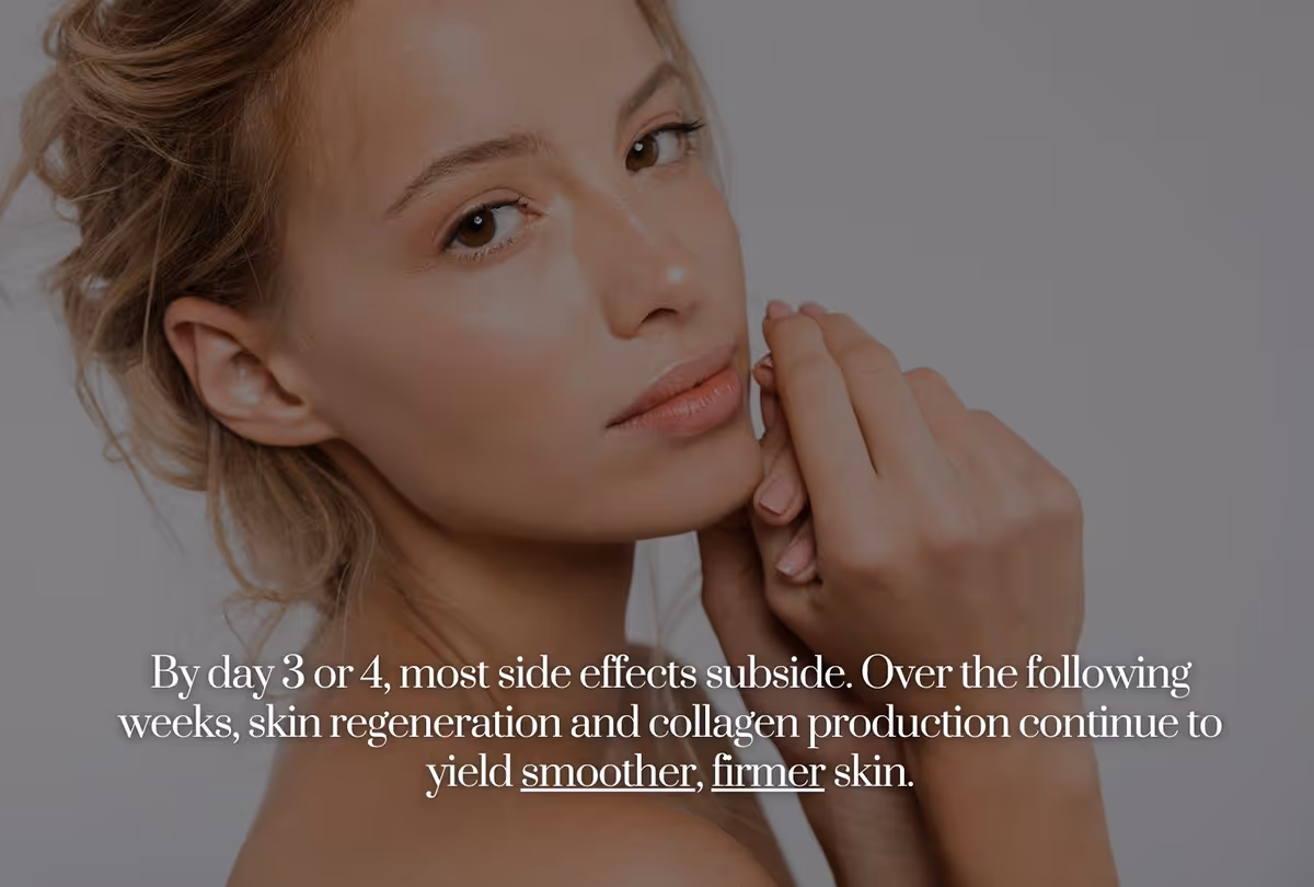 A Key Benefits of Microneedling