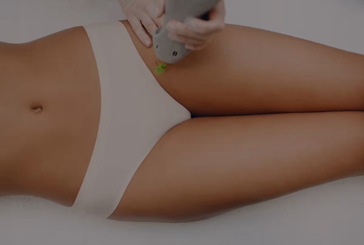 Does Laser Hair Removal Cause Cancer?