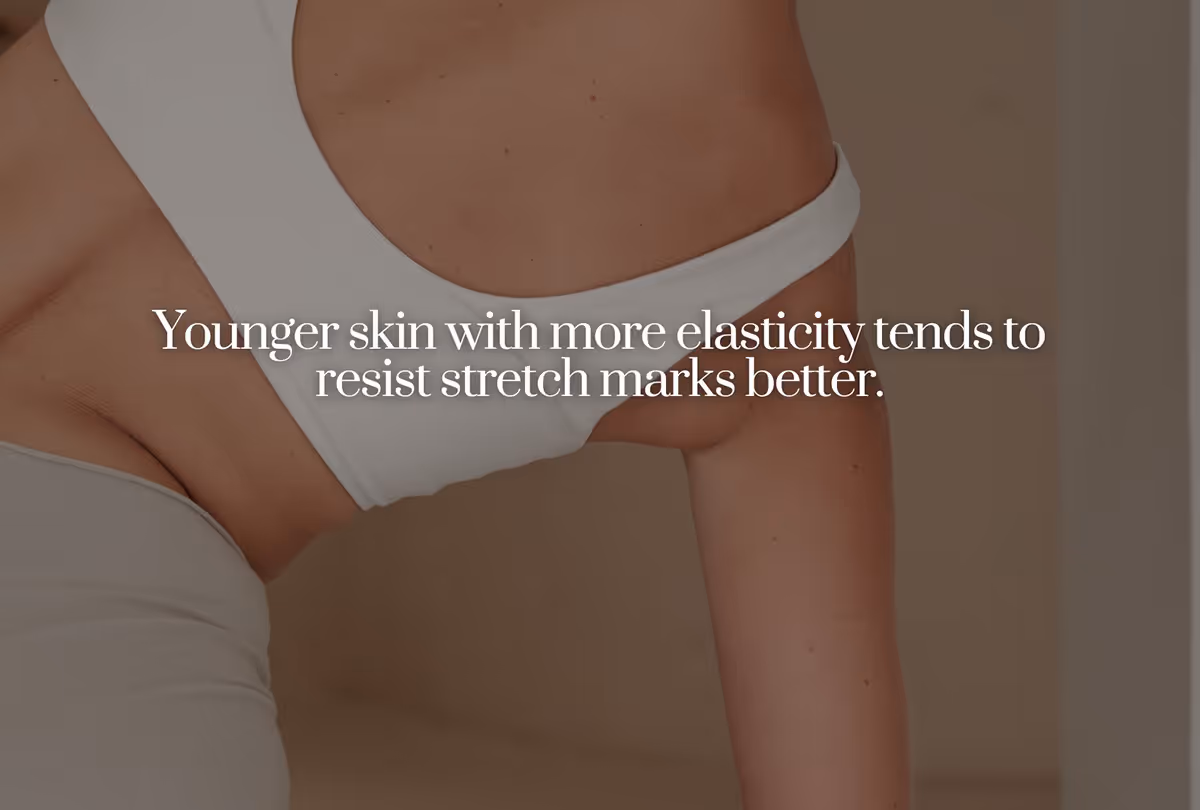 Factors Influencing Stretch Marks from Weight Loss