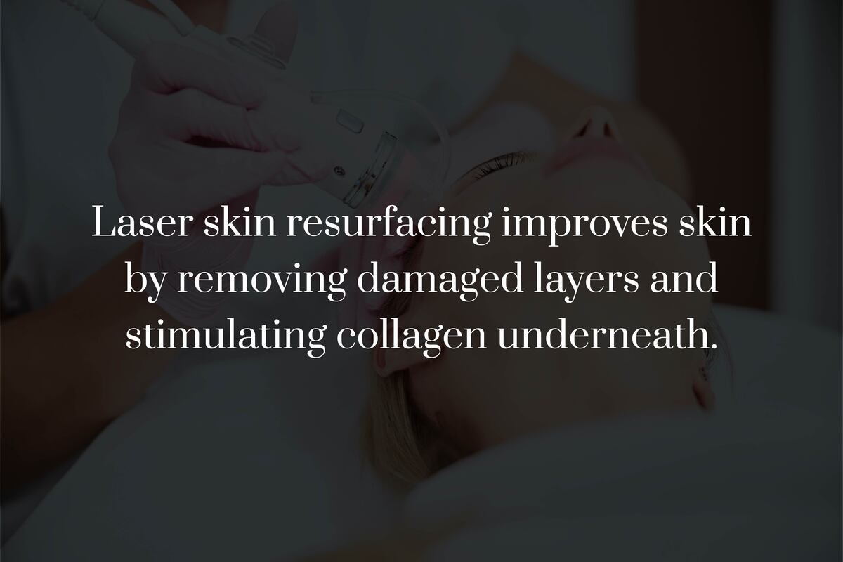 What Is Laser Skin Resurfacing and What Does It Treat?