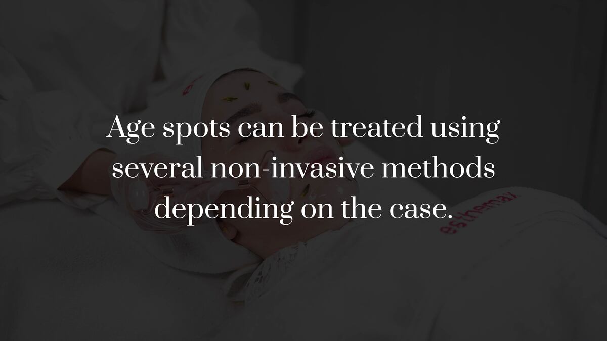 How to Get Rid of Age Spots Without Surgery