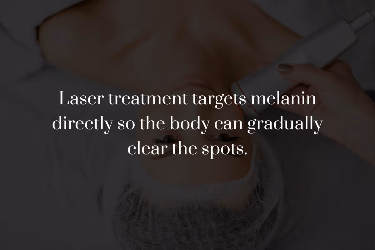 How Does Laser Treatment Remove Age Spots?