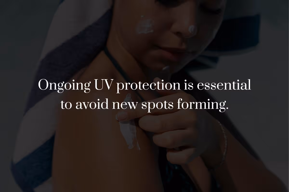 How Does Laser Treatment Remove Age Spots?