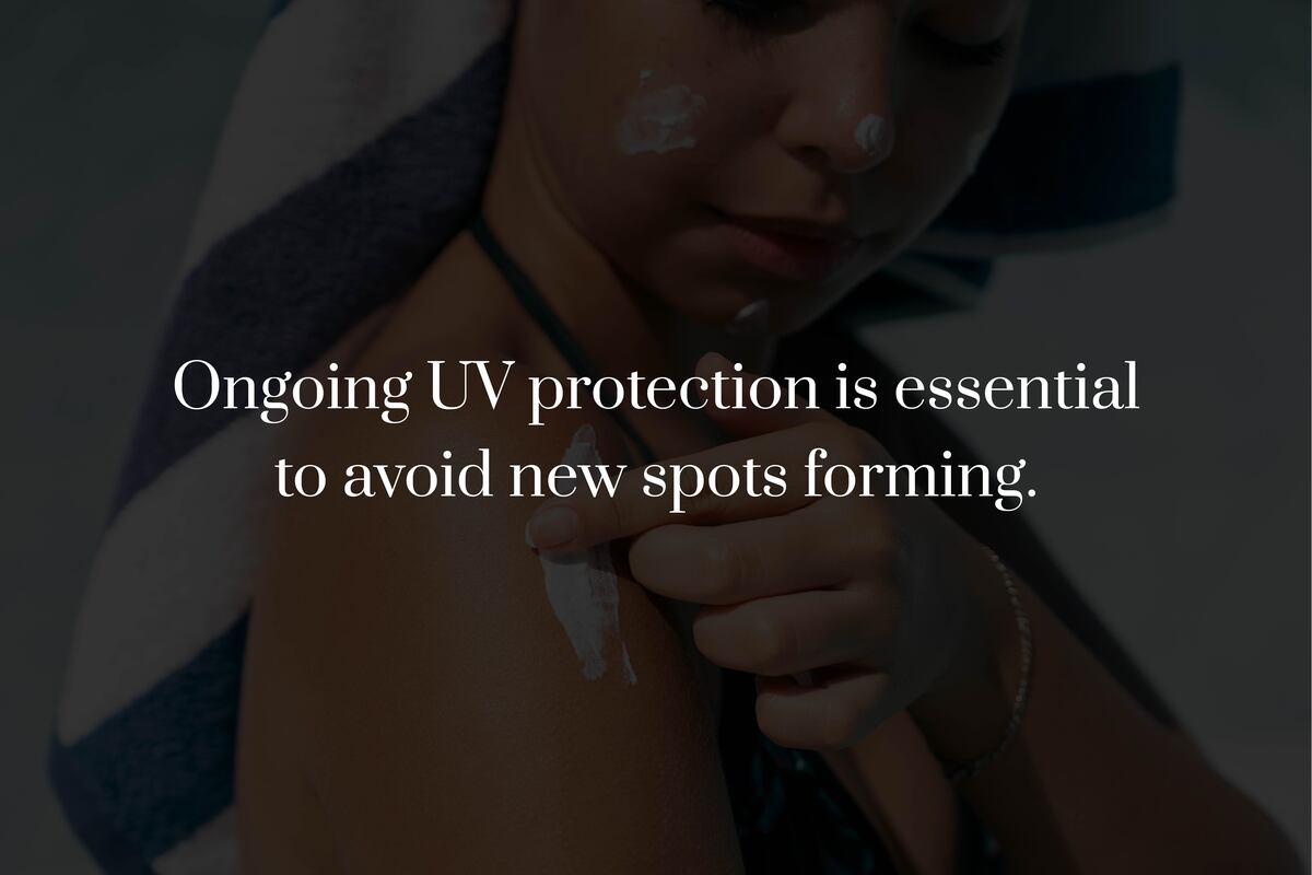 How Does Laser Treatment Remove Age Spots?