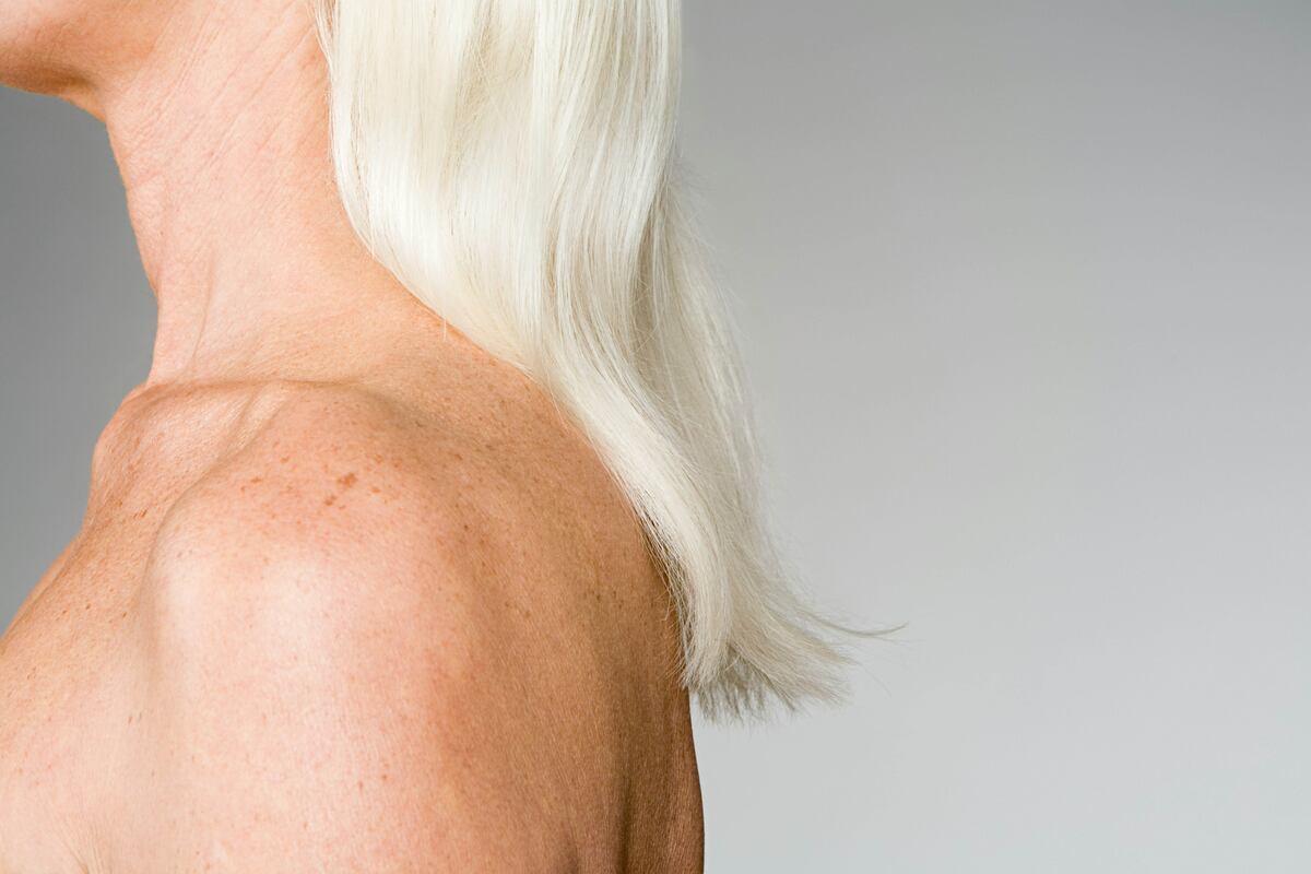 How to Get Rid of Age Spots Without Surgery