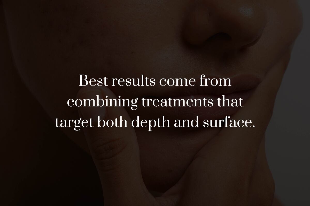 What Is the Best Treatment Plan for Acne Scars?